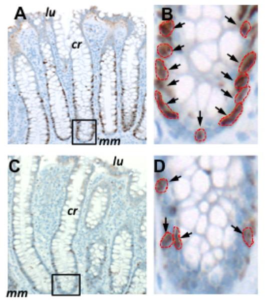 Normal Colon Resections