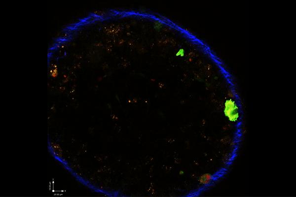 Toxoplasma Parasite 