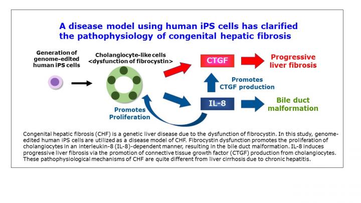 Congenital Hepatic Fibrosis