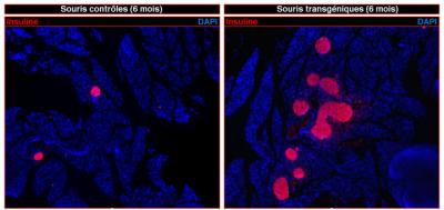 &#946; Cell Regeneration in the Pancreas