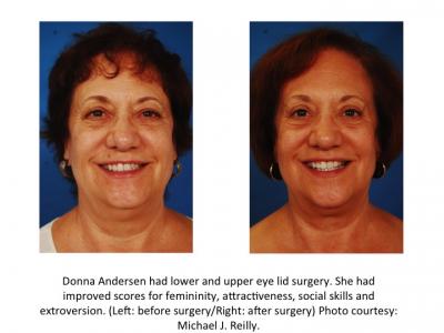 Study Participant Photos