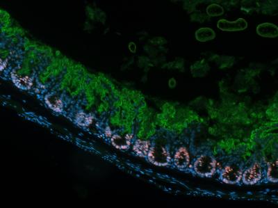 Striking Image (1 of 2)