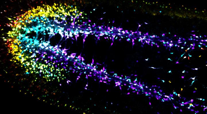 Pattern of the Planarian Brain