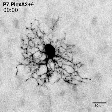 Don't Mess with the Proteins in My Eye (1 of 2)