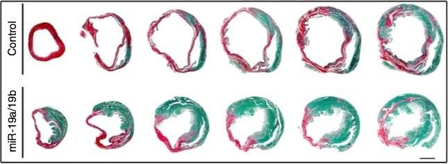 Regenerating Heart Muscle