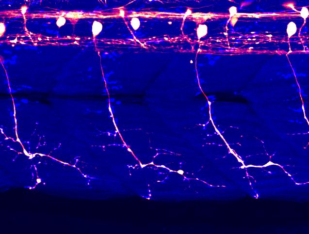 Spinal Motor Neurons in Zebrafish