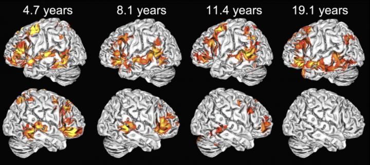 fMRI Brain Activation Map