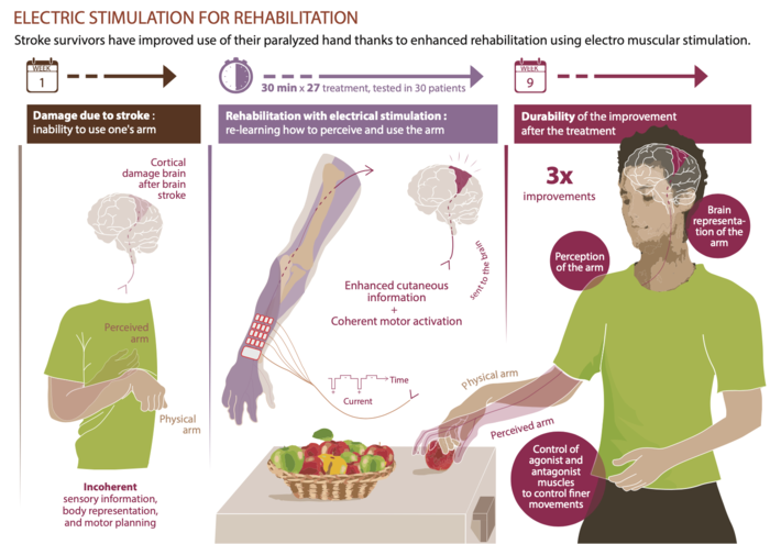 Infographic Stroke Rehabilitat Image Eurekalert Science News Releases