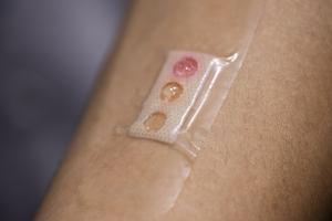 NTU Singapore scientists develop ‘band-aid’ that measures glucose levels in sweat using microlaser technology