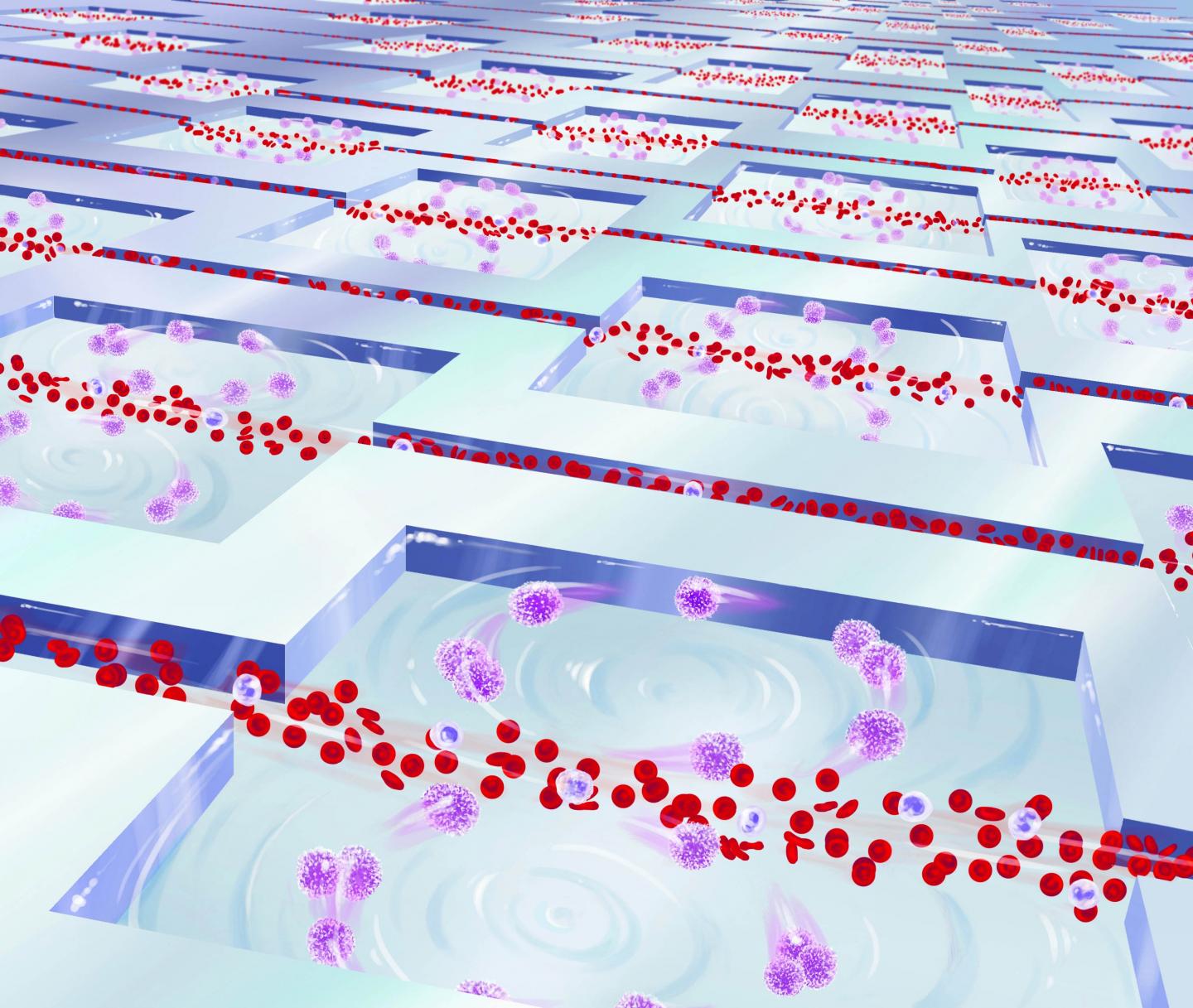 Capturing CTCs Using the Vortex Chip