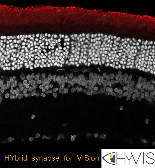 HyVIS: hybrid synapses to treat retinal dystrophies