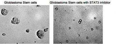 Glioblastoma Stem Cells With and Without STAT3 Inhibitor