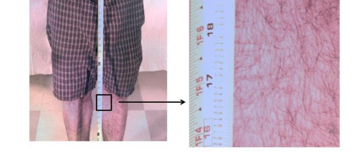 Segment of Whole-Body Image