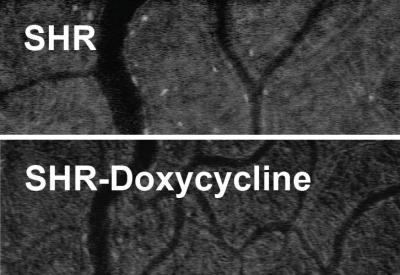 Common Denominator of Multiple Ailments