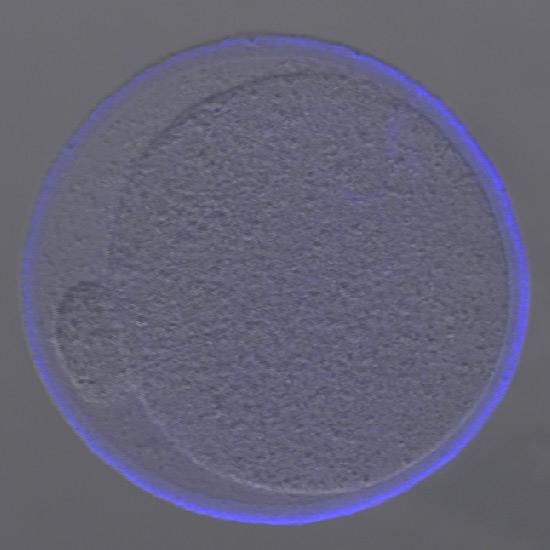 Long-Term Contraception in a Single Shot