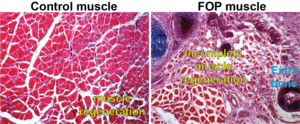 Comparison of control and FOP cell