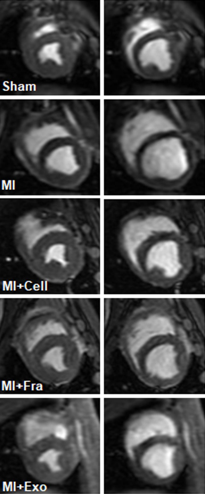 A "Cell-Less" Therapy May Regenerate Heart Tissue Without Cell Transplant Risks (2 of 2)