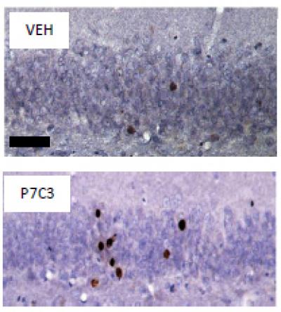 Compound Protects Newborn Neurons