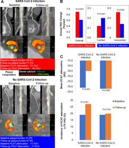 Virus That Causes COVID-19 Increases Risk of Cardiac Events