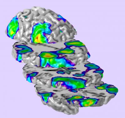 fMRI Image