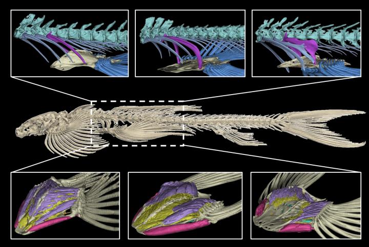 CT Scan Segmentations