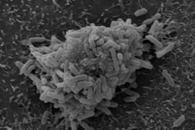 <em>Pseudomonas Aeruginosa</em>