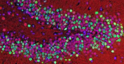 Malfunctioning Gene Associated with Lou Gehrig's Disease Leads to Nerve-Cell Death in Mice (1 of 2)
