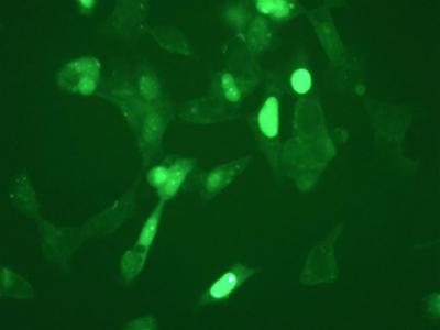 TXNIP in Beta Cells with ER Stress