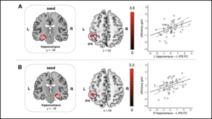 Brain Circuit Strength Predicts a Child’s Ability to Understand Numbers