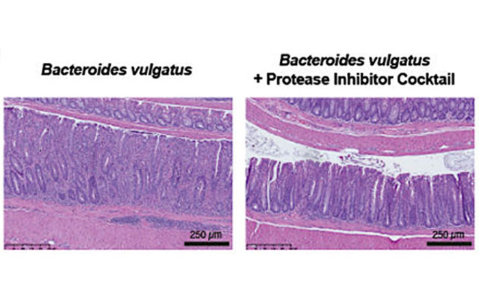 Bacteroides vulgatus graphic