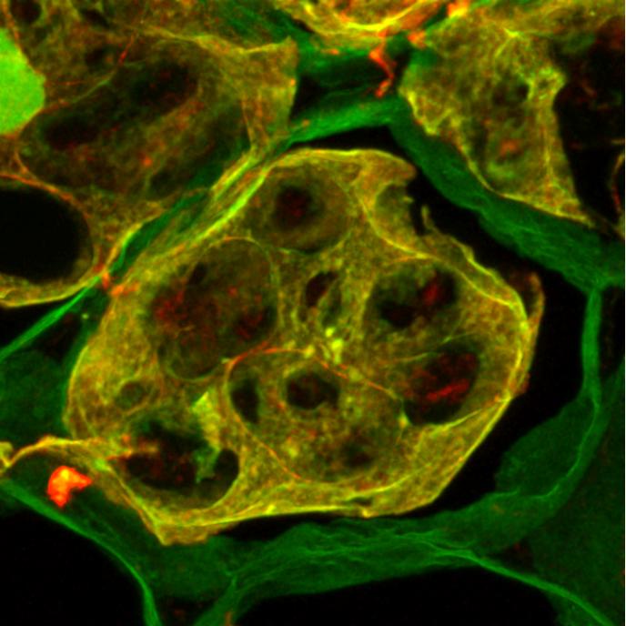 Highly Stable Amyloid Protein Aggregates May Help Plant Seeds Last Longer