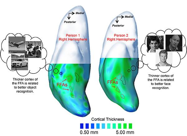 FFA Cortical Thickness