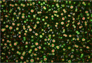 Liver section of a mouse with liver cells in green and red.