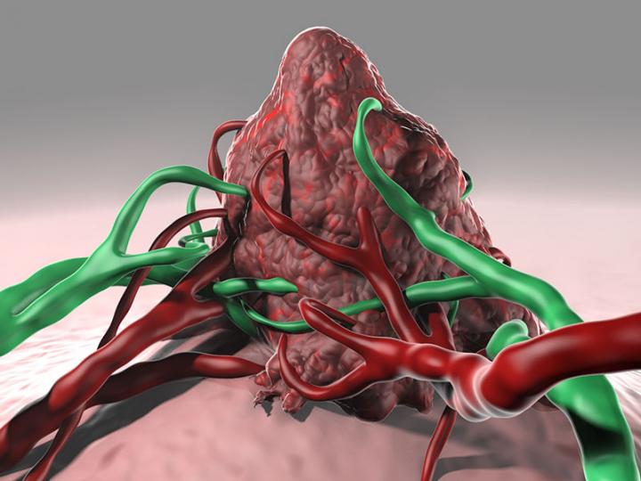 Enzyme-Activated Imaging Probe Lights up Cancer