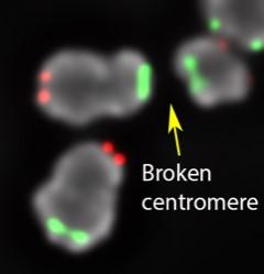 Image Showing Broken Centromere