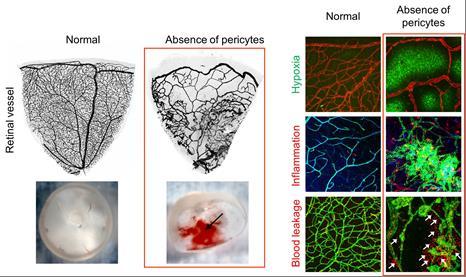 Damaged Blood-Retinal Barrier in the Absence of Pericytes