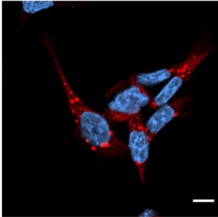 Fluorescence image of p62-positive puncta obtained using a confocal laser microscope