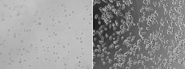 <i>N. fowleri</i> and Tamoxifen, UC San Diego Health