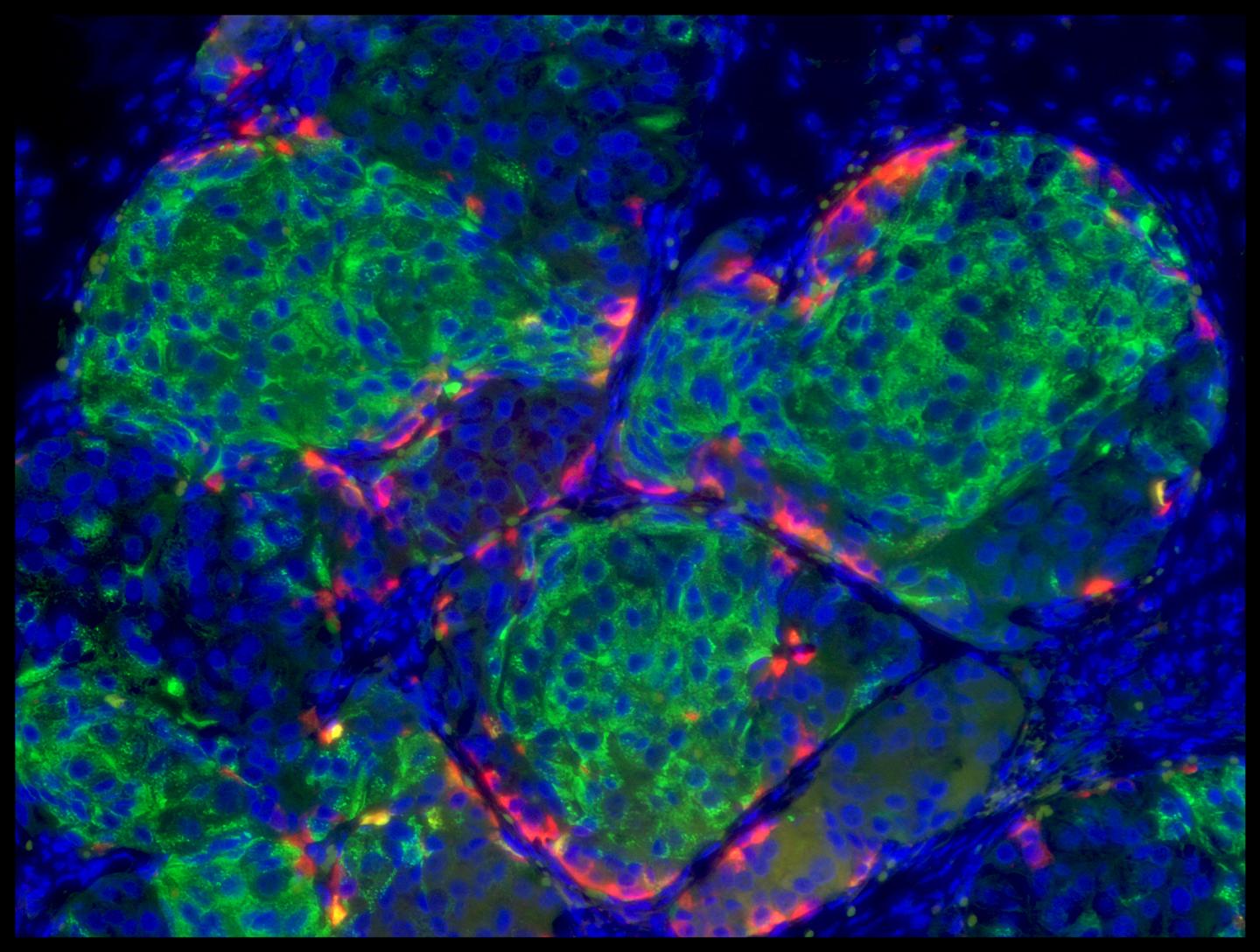 Human Stem Cell Derived Insulin Producing Beta Cell