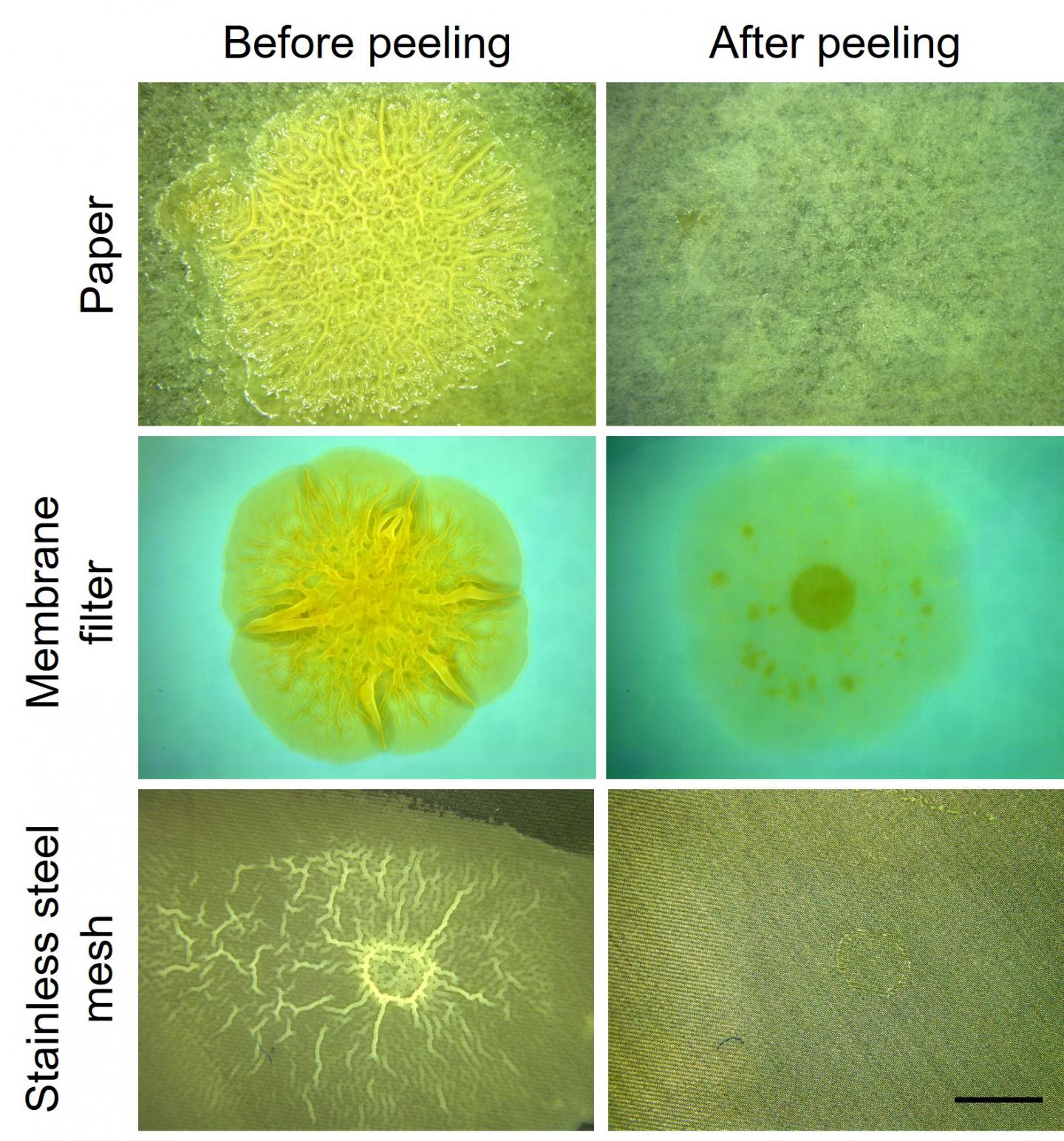 Biofilms Before and After Removal