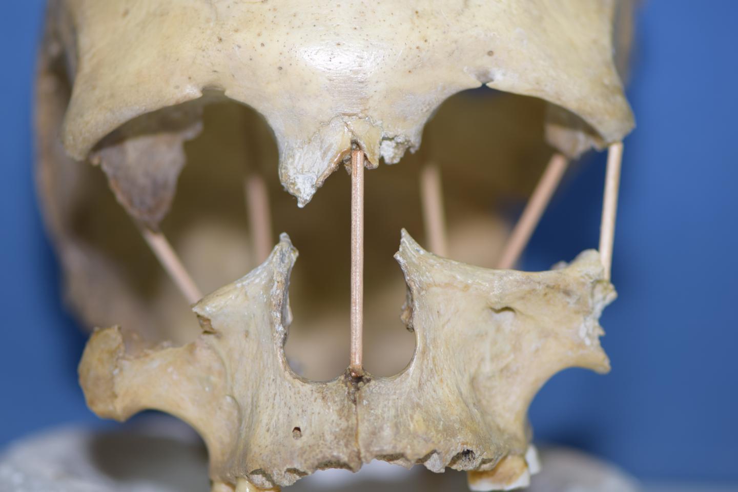 The skull of Pe&#351;tera Muierii 1, which entire genome is now successfully sequenced.