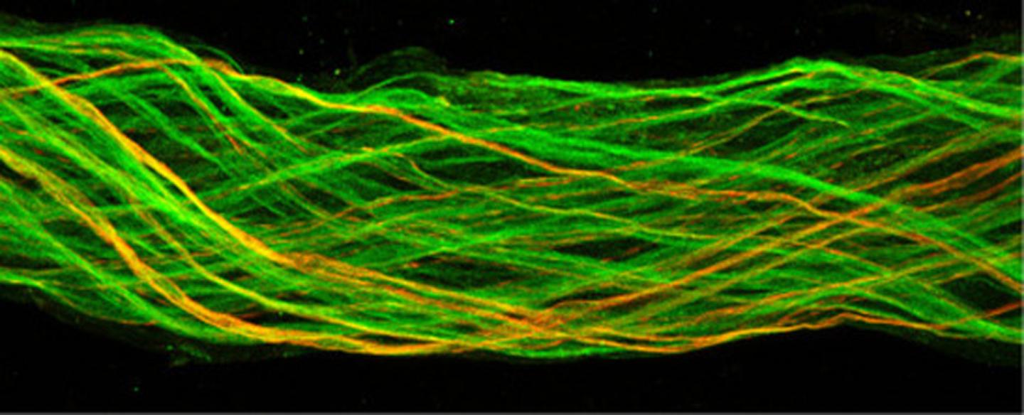 Neurons of the Adipose Tissue
