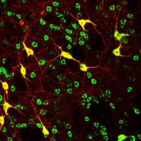 Striatal cholinergic interneurons