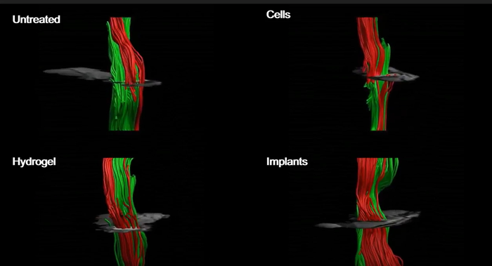 MRI of an injured spinal cord with and without treatment