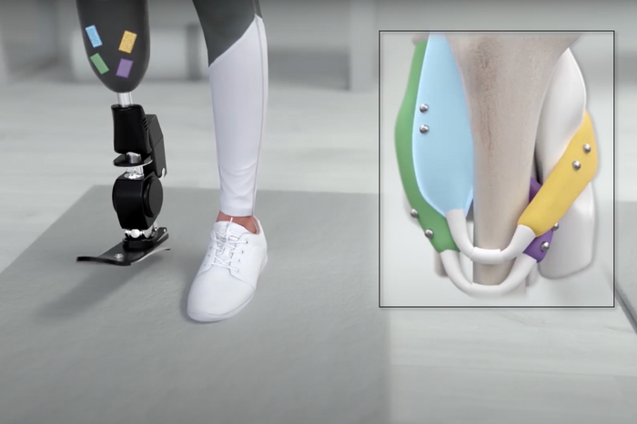 Magnetic sensors for prosthetic limbs