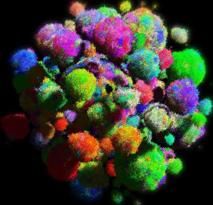 3-D Model of a Tumor