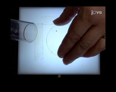 Treating Seizures With Metabolism-altering Drugs