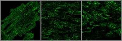 JP2 Protein in Heart