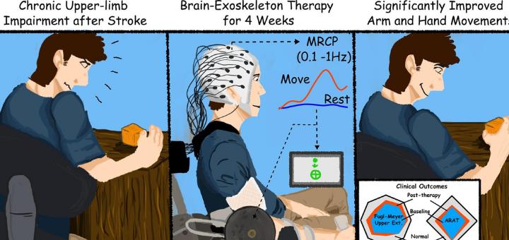 BMI-stroke Rehab