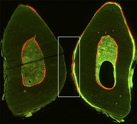 Image of a Bone Sample [IMAGE] | EurekAlert! Science News Releases